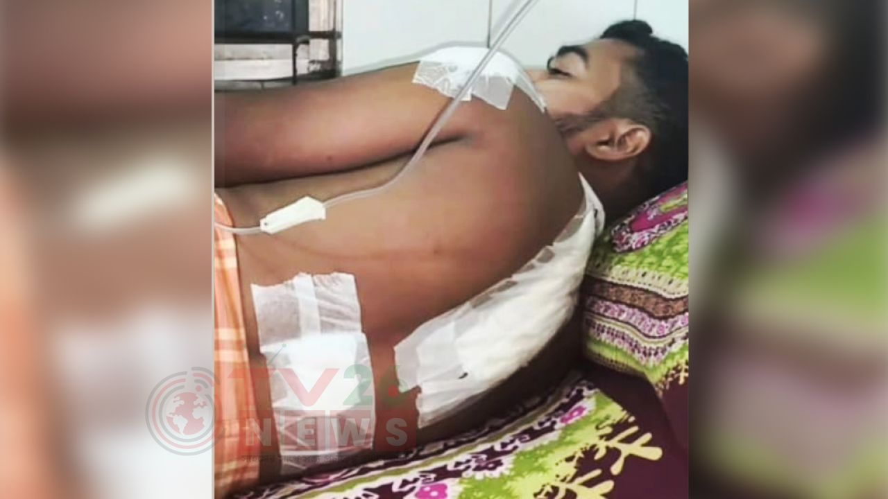 ফরিদপুরে খবর সংগ্রহে গিয়ে ছিনতাইকারীর হামলায় সাংবাদিক আহত