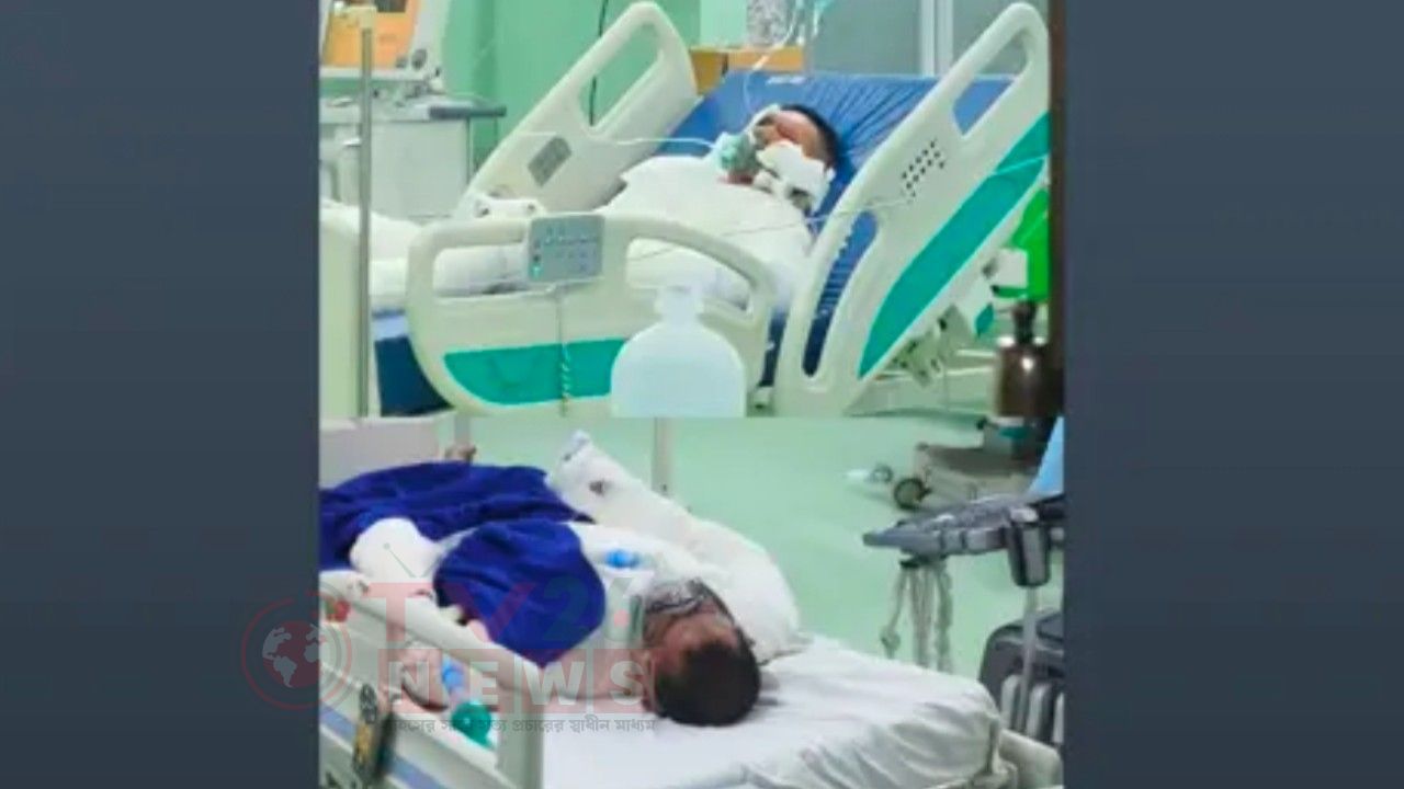 মিরসরাই ইকোনমিক জোনে ফার্নেস দুর্ঘটনা, চীনা নাগরিকসহ আহত ৪