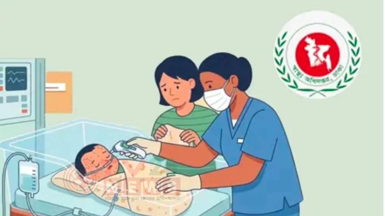 হাম উপসর্গে আরো ৮ জনের মৃত্যু