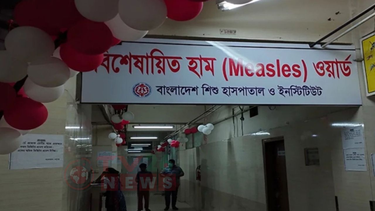 ২৪ ঘণ্টায় হামের উপসর্গ নিয়ে চারজনের মৃত্যু, আক্রান্ত ১৩৯০